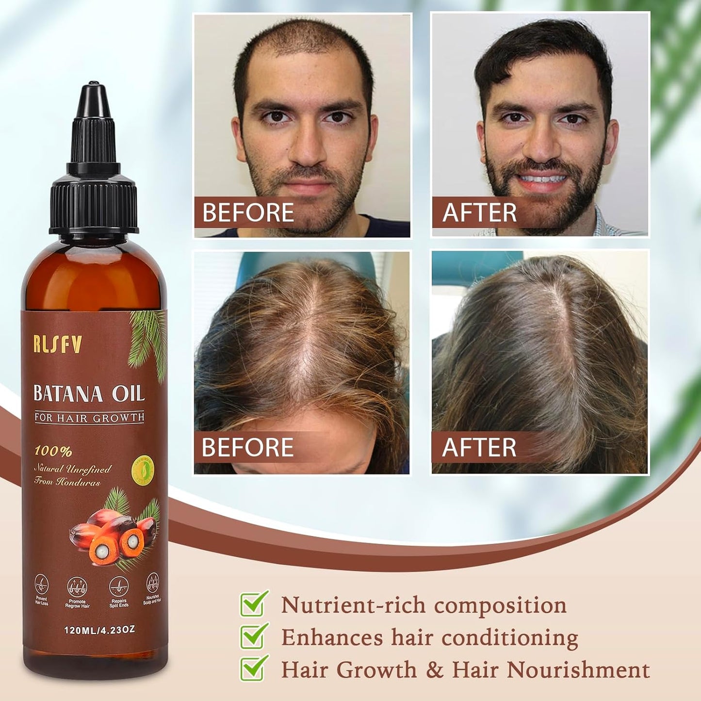 Organic Batana Oil For Hair Growth: Batana Oil for Women & Men - Hair Growth Product for preventing hair loss. 4.2 OZ