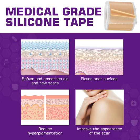 Scar Silicone Gel Sheets for Stretch Marks: Advanced Scar Removal Sheets for Old and New Scars from Surgery - C Section - Burns - Acne - Injury - Keloid Treatment for Skin Types of Ears - Face - Body